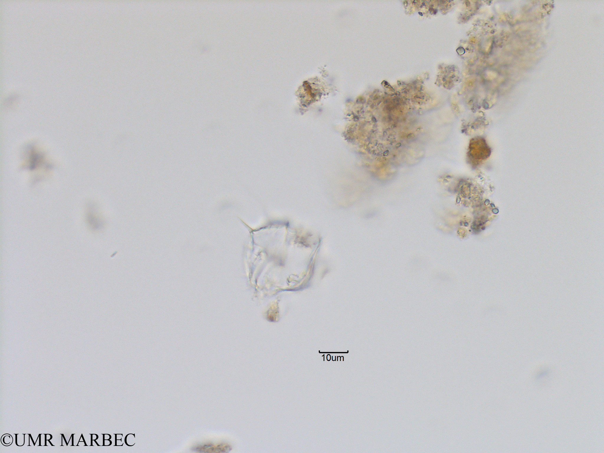 phyto/Bizerte/bizerte_lagoon/RISCO November 2015/Protoperidinium quinquecorne (Lagune_T1_C_Gonyaulax gde epine-14).tif(copy).jpg